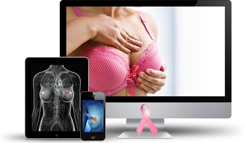 Breast Cancer Surgeon